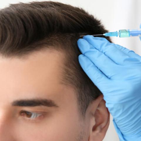 Saç Ekimi, PRP, Mezoterapi: Saç ve Cilt Sağlığınız İçin Üç Etkili Çözüm